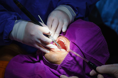 doctor cleaning the teeth patient with ultrasonic tool. Removal of tartar and plaque, prevention of...