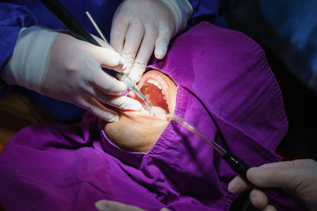 doctor cleaning the teeth patient with ultrasonic tool. Removal of tartar and plaque, prevention of dental disease paradontitis.の写真素材