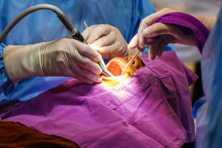 doctor cleaning the teeth patient with ultrasonic tool. Removal of tartar and plaque, prevention of dental disease paradontitis.の写真素材