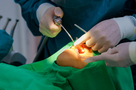 doctor cleaning the teeth patient with ultrasonic tool.の写真素材