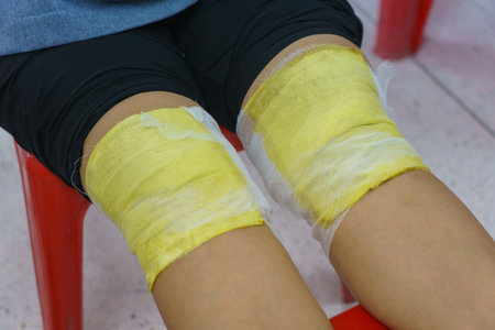 Knee pain relief with herbal. Knee osteoarthritis. Thai traditional medicine.の写真素材