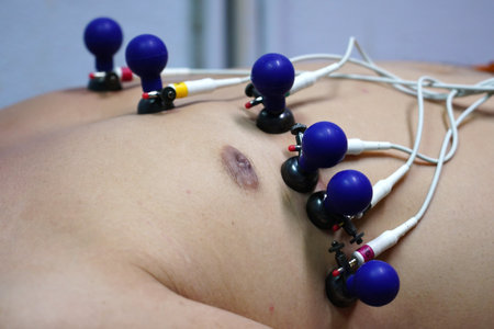 ECG or EKG of man with electrodes for electrocardiogram records on bed in hospital.の写真素材