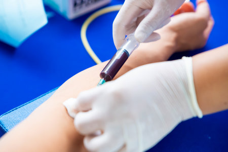 Close up hand collecting blood sample for diagnosis and treatment patient in the hospital.Laboratory technician taking blood for blood chemistry analysis.の写真素材