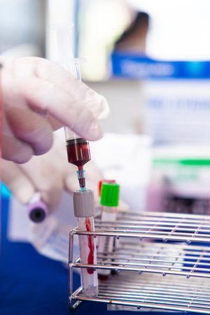 Close up blood sample for diagnosis and treatment patient in the hospital.Laboratory technician taking blood for blood chemistry analysis.の写真素材