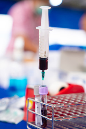 Close up blood sample for diagnosis and treatment patient in the hospital.Laboratory technician taking blood for blood chemistry analysis.の写真素材