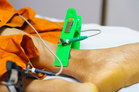 ECG or EKG of man with electrodes for electrocardiogram records on bed in hospital.の写真素材