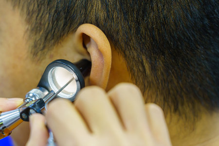 Patient is seen by an otolaryngologist. ENT doctor examines a patient. An otolaryngologist examines a patient's inner ear using an otoscope. Treatment of inflammation disease of ears.の写真素材