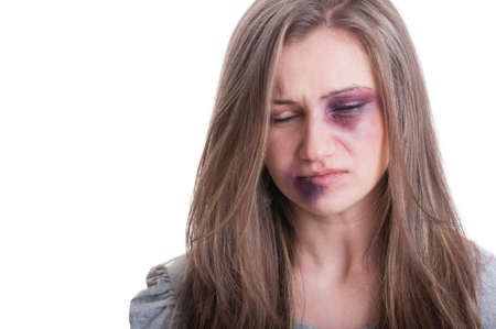 Domestic violence victim concept with a beaten woman portraitの写真素材