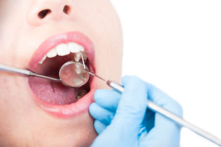 Close up of female patient having teeth examination by stomatologist as oral healthcare concept