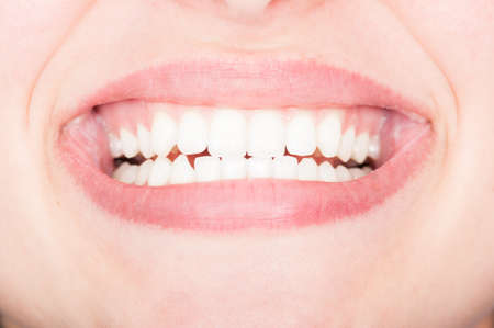 Close-up of beautiful perfect white smile like healthy dentist conceptの写真素材