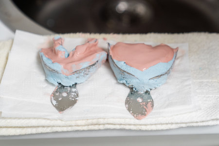 Dental impression trays showing accurate bite registration preparing for custom tray fabrication