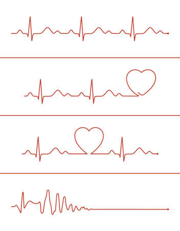 Set of various cardiogram design elements. Cardiogram lines of healthy heart and heart stopのイラスト素材
