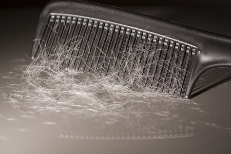 Hair loss problem treatment essentiel oil pillsの写真素材