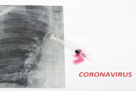 Novel Covid-19, virus concept . Text phrase Coronavirus with red letters close to lungs radiology...