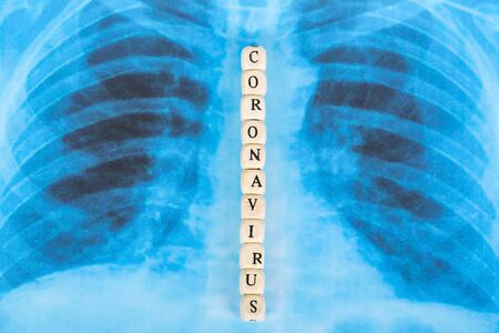 Text phrase Coronavirus with wooden letter on lungs radiology blue image background. Copy space.の写真素材