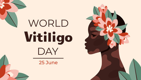 World vitiligo day. Young beautiful black woman with vitiligo patches. African American girl with plumeria flowers. Diversity and support concept. Portrait art. Vector cartoon flat Illustrationのイラスト素材