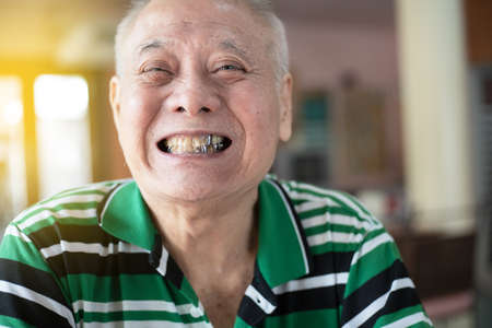 Smiling senior man showing his teeth with full metal crownの写真素材