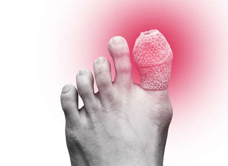 close up of woman right foot with a wounded on big toe. Isolated on white background. Accident and...