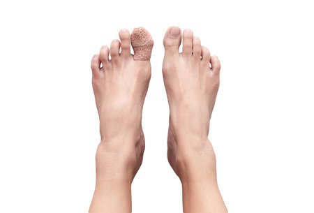 Top view picture of two bare human female feet with a wounded big toe healed with bandage for...
