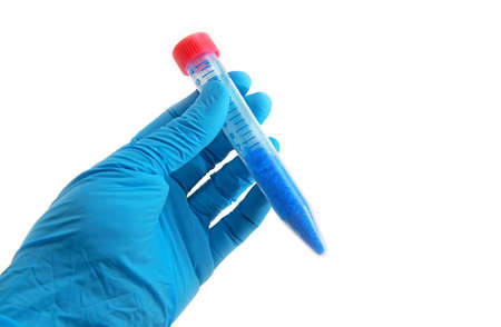 arm in glove with laboratory tube with chemicals over white