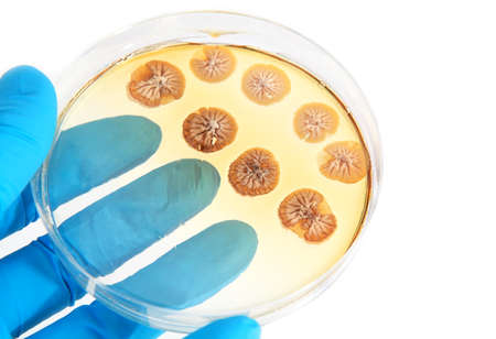fungi microorganisms on agar plate in laboratory on white background