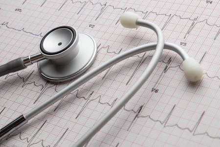 Stethoscope on the ECG. medical symbolic close-up photo