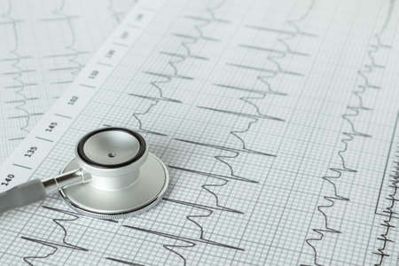 Stethoscope on the ECG. medical symbolic close-up photoの写真素材