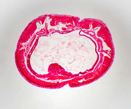 A thin cross section of a common Earthworm magnified many times for Biologyの写真素材