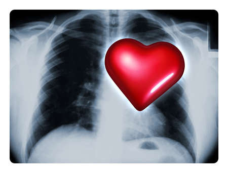 X-ray of a male chest showing one big red heartの写真素材