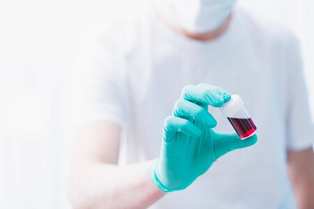 Doctor holds the blood test tube with positive test on coronavirus.の写真素材