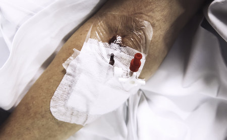 Intravenous via in the arm of a hospital patient, health and medicine