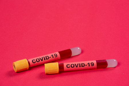 vacuum tube with blood and the word covid-19 on the identification tag on a red background