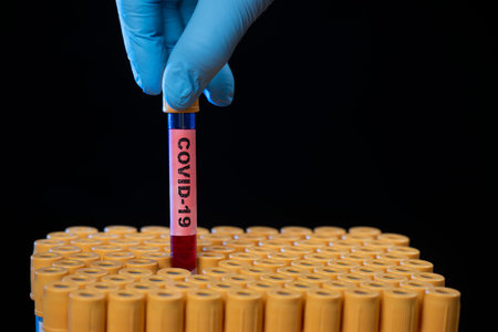 Health professional holding blood sample tube for COVID-19 or coronavirus in tray