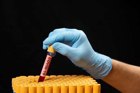 Health professional holding blood sample tube for COVID-19 or coronavirus in tray
