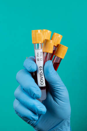 hand holding vacuum blood tube labeled Covid-19の写真素材