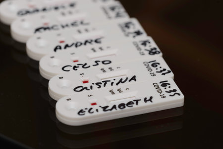 Test kit for viral disease COVID-19 nCoV. Laboratory card kit test for coronavirus. COVID-19 rapid...
