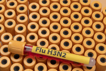 blood collection tubes labeled "Flu H3N2" symbolizing the flu epidemicの写真素材