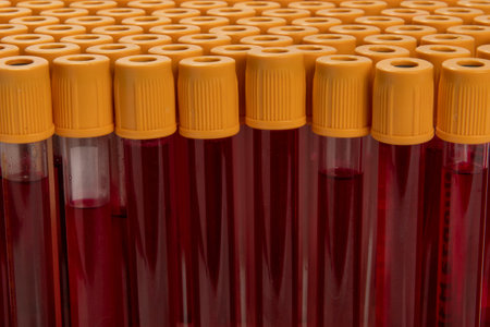 blood collection tube lined up, all ready for testing