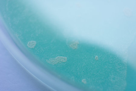 Fungi culture on petri dish plate. Mushroom cultivation. top view. Fungi culture on petri dish...