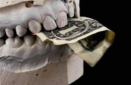 Jaws hold banknote
