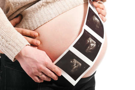 young couple is waiting their babyの写真素材