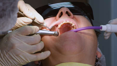 Oral surgeon drilling hole in senior woman gum to open installed dental implant. Dentist with assistant work with a patient in modern dental clinicの写真素材