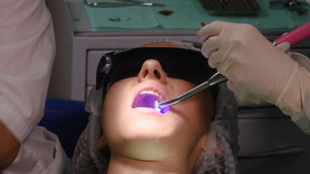 Applying resin based composite filling on tooth and curing it with LED. Young woman at dental clinic. Female dentist with assistant treating cavities in a patient mouth in modern dental office.の写真素材