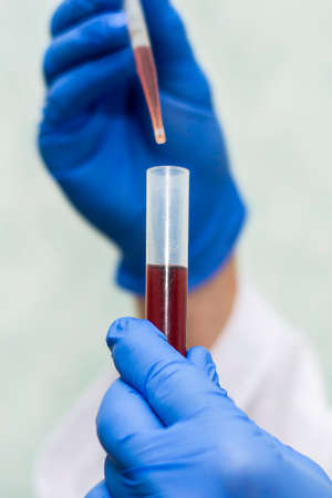 a medical worker in a white coat and blue gloves draws blood from a test tube with a pipette for analysis. High quality photoの写真素材