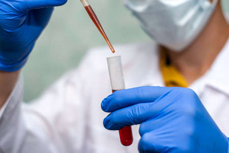 a medical worker in a white coat and blue gloves draws blood from a test tube with a pipette for analysis. High quality photoの写真素材