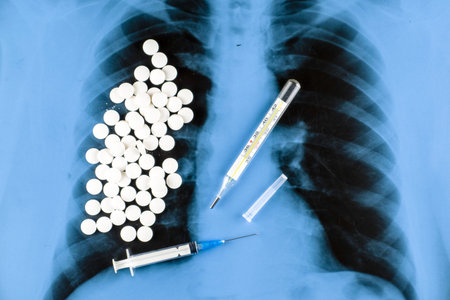 scattered pills, a syringe and a thermometer against the background of an X-ray of the lungs. High...