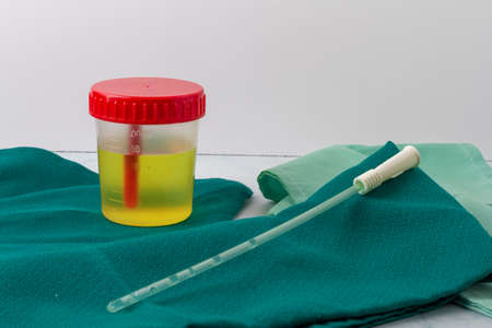 Bladder catheter and container with urine for analysis on a table with green hospital tableclothsの写真素材