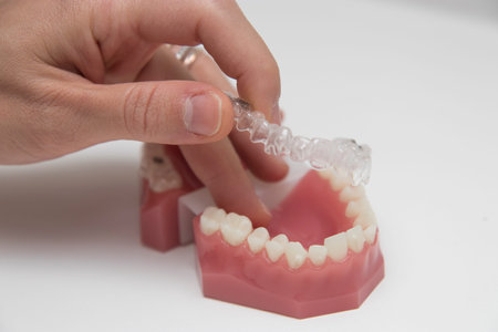 Close up detail of invisalign medical equipment on white background.