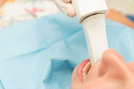 Close up detail of a dentist mouth scanner in action.の写真素材