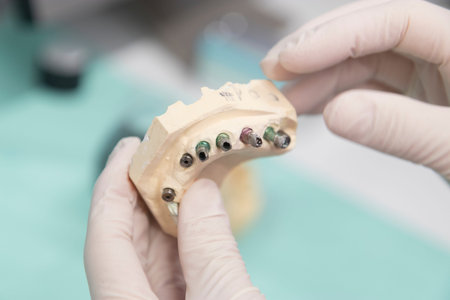 Close up detail of dentist tools for healthcare and surgery.の写真素材